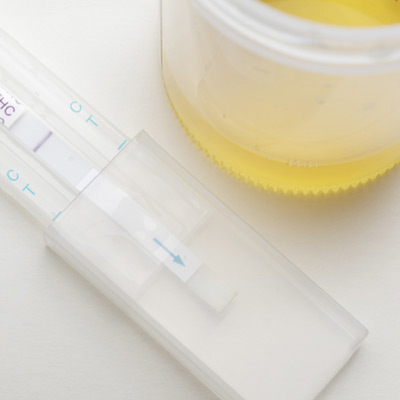 Urine-Drug-Test