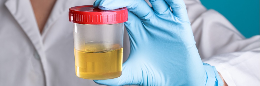 Synthetic Urine